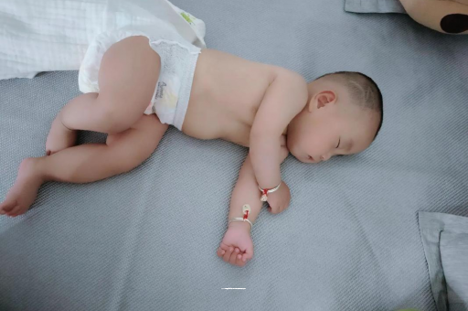 肇庆六个月宝宝眼睛散光